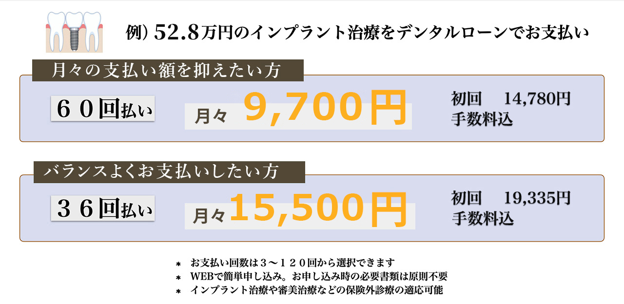 デンタルローンでのお支払いシュミレーション