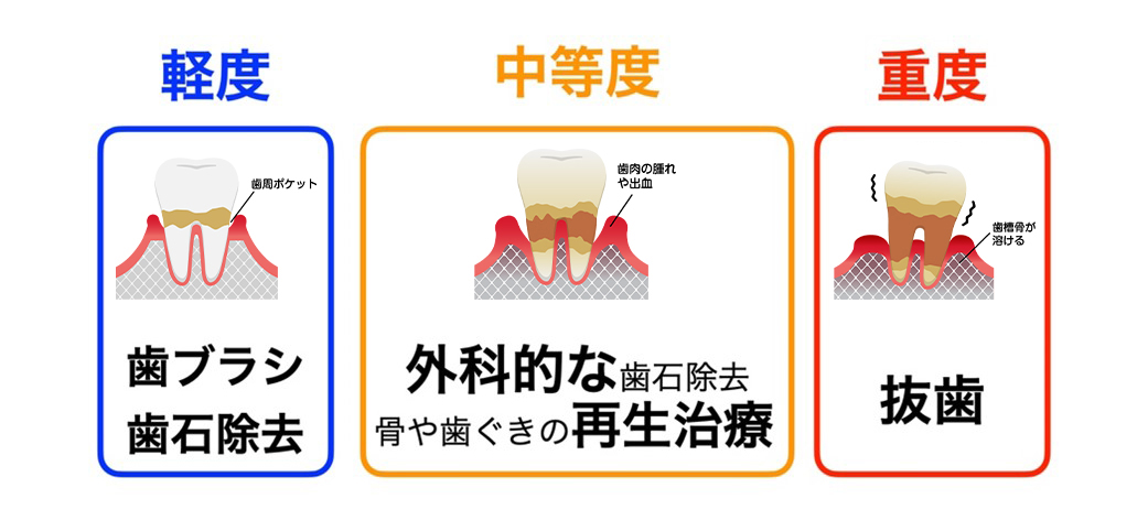 ３、正確かつ適切な治療を選択